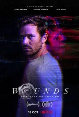Wounds (2019) Prints and Posters